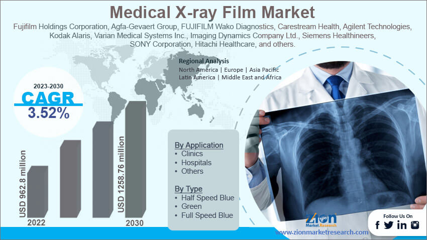 Global Medical X-Ray Film Market Size