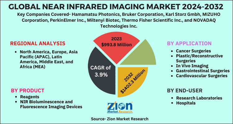 Near Infrared Imaging Market