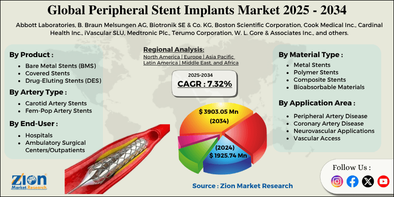 Peripheral Stent Implants Market