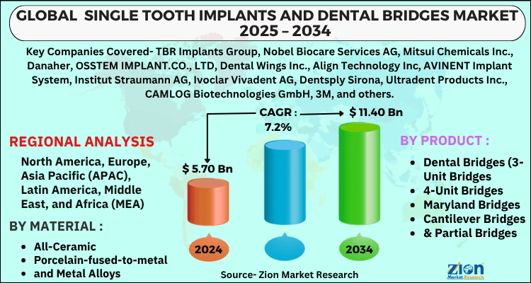 Single Tooth Implants and Dental Bridges Market