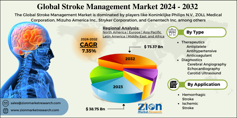 Stroke Management Market