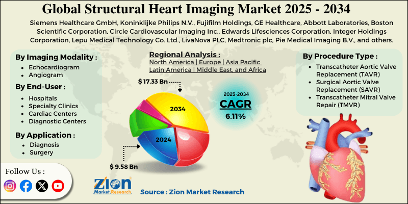 Global Structural Heart Imaging Market