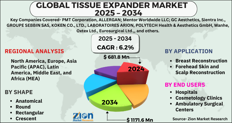 Tissue Expander Market