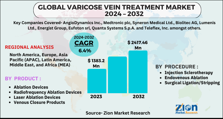 Varicose Vein Treatment Market